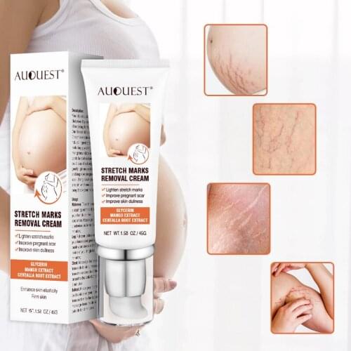 Removes Stretch Mark Cream To Remove Postpartum Obesity Pregnant Women Repair Anti-Aging Anti-Winkles Firming Body Cream