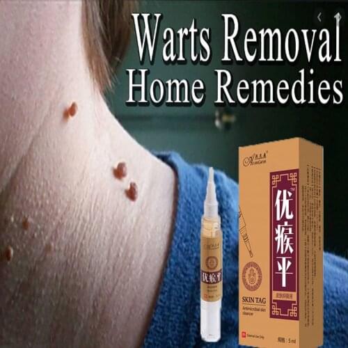 5ML Skin Tag Remover Against Mole & Genital Wart fast RemovWithin al Anti Foot Corn Warts Papillomas Rapidly removes moles