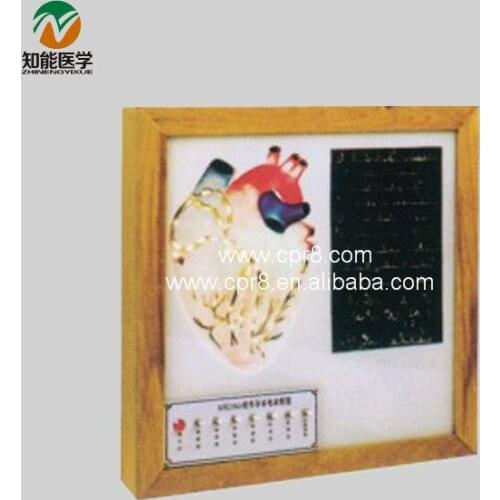 BIX-A1076 Cardiac Conduction System Electric Model Medical Aids WBW397