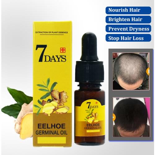 Okenys Ginger Hair Growth Essence Spray 20ml Grow Restoration Bread Oil Serum for Man Woman Anti Hair Loss Prevent Baldness