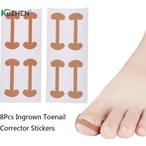 8Pcs=2sheet Ingrown Toenail Corrector Stickers Paronychia Treatment Recover Corrector Pedicure Tools Fingernail Toe Nail Care