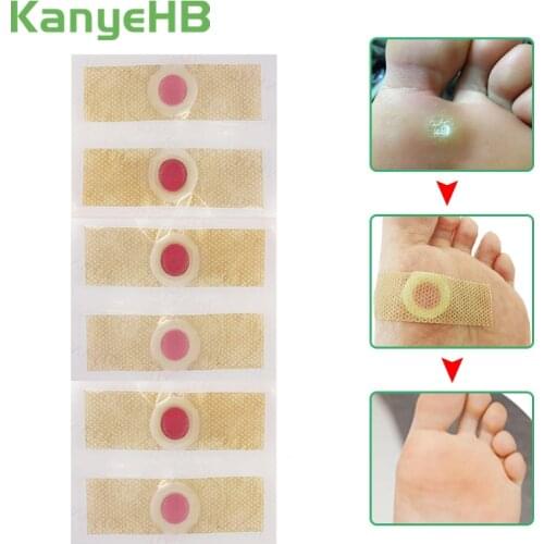 30pcs Foot Care Sticker Medical Patch Corn Removal Pads Warts Thorn Curative Patches Calluses Remove Callosity Detox A175