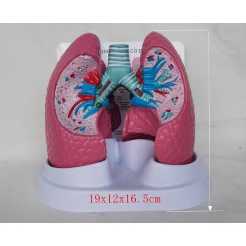 Human pathological lung anatomy surgery biology