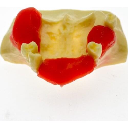 New Dental Sinus Lift Practice Teeth Model Typodont Study Model #2013 01