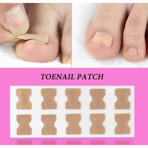 10pcs/set Toenail Correction Patch Stickers Fingernail Paronychia Inlays Treatment Ingrown Toenail Corrector Care Pedicure Tools