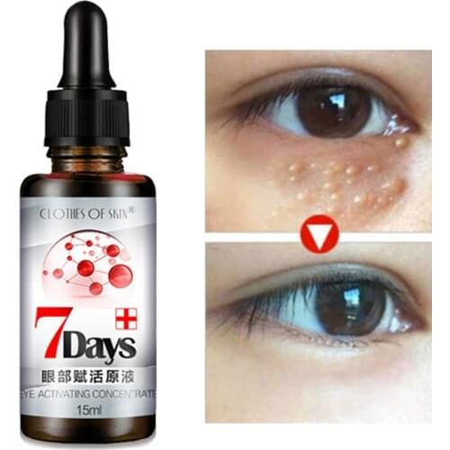 Eye revitalizing solution Dilute dark circles Remove eye lines eye Remove anti-ag Lighten Anti-wrinkle cream grains bags fa H9V0