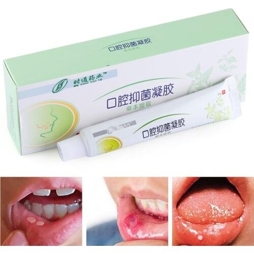 Mouth Ulcer Relief Gel Natural Herbal Oral Hygiene Antibacterial Cream Severe Pain Irritation Bad Breath Inflammation
