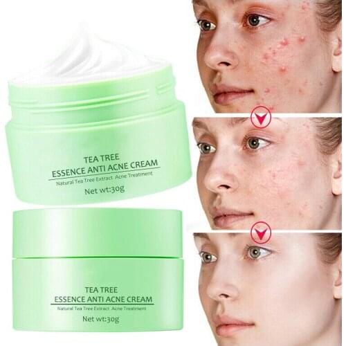 30g Tea Tree Acne Remove Cream Anti Acne Cream Scar Repair Facial Spot Removal Face Skin Treatment Care Improve Blain Muscle