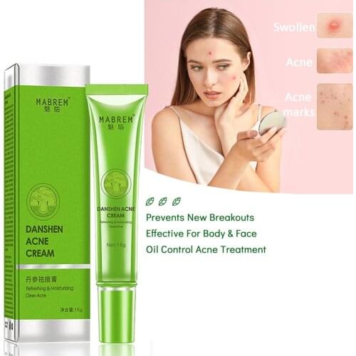 Effective Acne Removal Cream Acne Treatment Fade Acne Spots Oil Control Shrink Pores WhiteningS wollen Acne Cream Skin Care