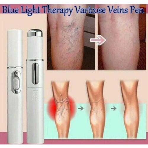 1pc Medical Blue Light Therapy Pen Varicose Veins Treatment Soft Scar Removal Treatment Scar Acne Just 7 Days