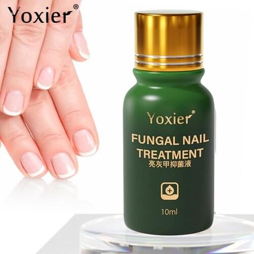 Yoxier Effective Fungal Nail Treatment Improve Thickening Atrophy Shedding Nourish Repair Herbal Formula Onychomycosis Foot Care