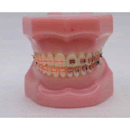 28pcs Teeth with Metal and Ceramic Orthodontic Model Dental Model