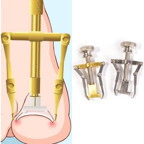 NEW Ingrown Toe Nail Fixer Pedicure Recover Embed Toenail Correction Lifter Tool