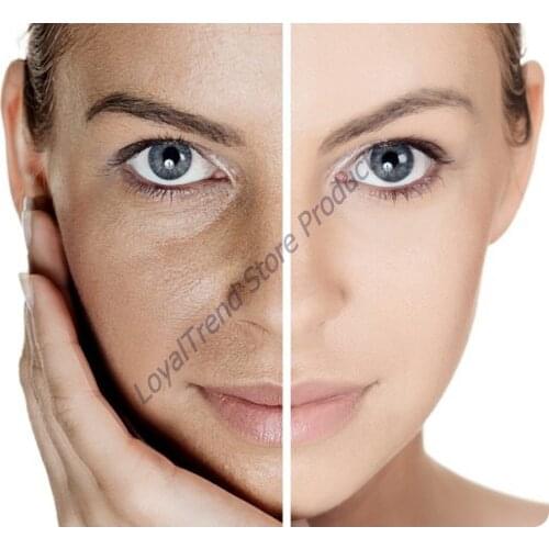 Щетки для тела Ruşur Sefidab China At AliExpress