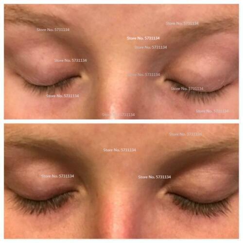 Urge Lash Boost Eyelash Growth Serum (3) Month Supply Chemo,Pregnant Safe Vegan