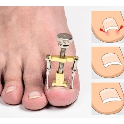 1 pc nail tools toenail curl correction pliers ingrown nail correction device nail picking device nail correction device