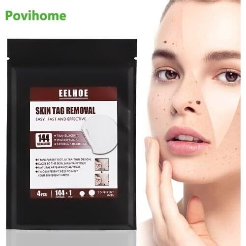 144Pcs/bag Wart Remover Patch Mole Foot Skin Tag Sticker Cure Dark Spot Pad Filamentous Calluses Wart Painless No Scar Leaving
