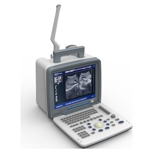 Factory price china portable ultrasound scanner pregnancy diagnosis black and white ultrasound scanner machine