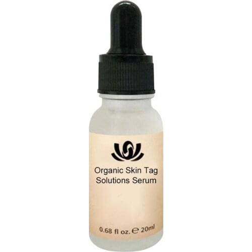 20ml Remover Serum Painless Mole Skin Dark Spot Mole Removal Spot Water Face Wart Tag Freckle Removal Cream Oil Plaster