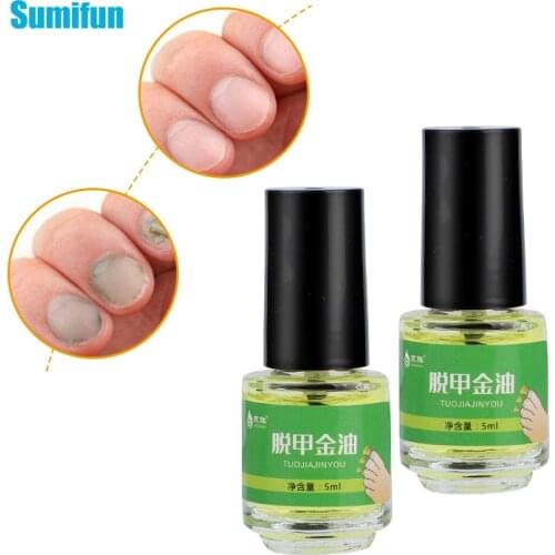 5ml Anti Fungal Nail Treatment Remove Onychomycosis Nail Repair Essence Oil Antibacterial Oil Onychomycosis Removal Foot Care