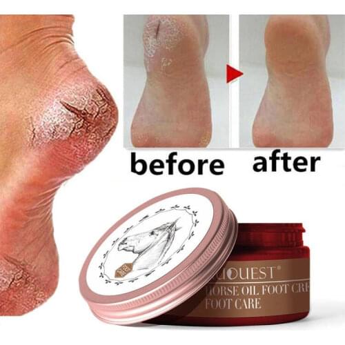 VOVA Foot Masks