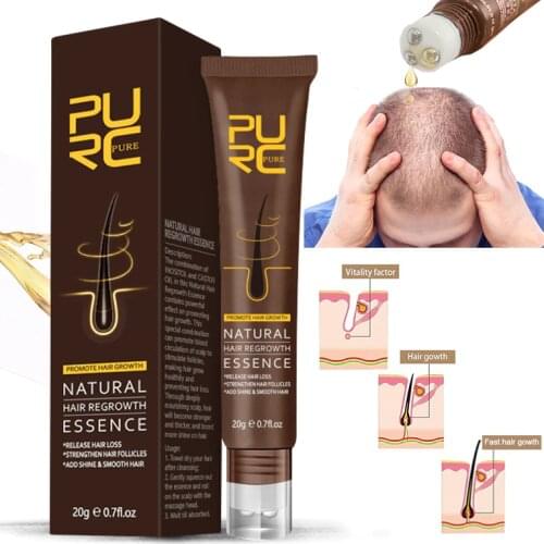 PURC Hair Growth Oil Prevent Hair Loss Treatment Ginger Extract Growing Hair Products for Hair Care and Scalp