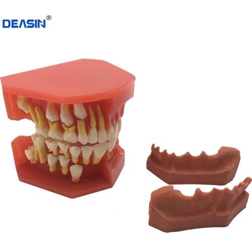 Dental Children Removable Deciduous Teeth Model Permanent Tooth Alternative Display Studying Teaching Tool