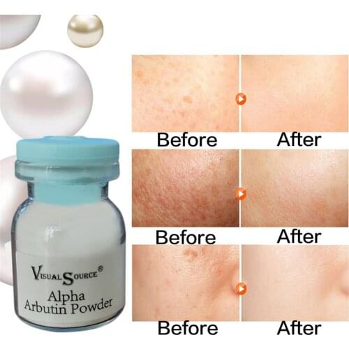 Skin Whitening Arbutin Powder Raw Material Powder Of Arbutin Anti-aging Skin Care Whitening Lightening Serum