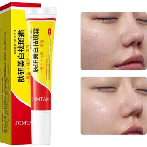 Effective Whitening Freckle Cream Remove Melasma Acne Spot Pigment Melanin Dark Spots Pigmentation Moisturizing Whitening Cream