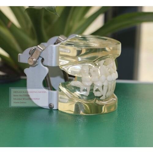 Transparent Milk Teeth Alternating Model,Childrens Teeth Growth Model,Model 5 to 9 Years Old Childrens Teeth