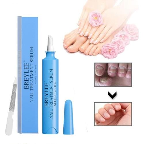 Fungal Nail Repair Pen Treatment Foot Nail Fungus Anti-Fungal Infection Paronychia Onychomycosis Essence Hand Foot Care 10ML