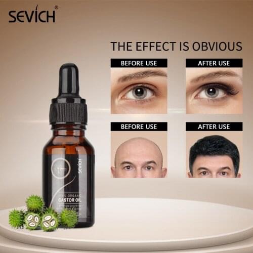 Sevich 100% Pure Organic Castor Oil 15ml Hair Essential Oil Eyelash Growth Serum with Mascara Brushes Eyebrow Fast Growth Liquid
