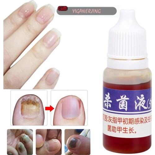 Масла для кутикулы YIGANERJING China At AliExpress