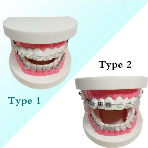 1 Piece Dental Orthodontic Teeth Model Metal/Ceramic Brackets Contrast Adelomorphic Ligature Tie Buccal Tube NiTi Archwire