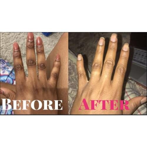 African Body Scrub Gel Natural Skin Brightening Lemon Kojic Acid Scrub Super Whitening Cream To Remove Darkness Knuckles