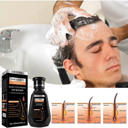 250ml Hair Growth Shampoo Ginger Deep Nourish Hair Shampoo Essence Prevention Hair Loss Promote Growth Anti-Hair Loss Product