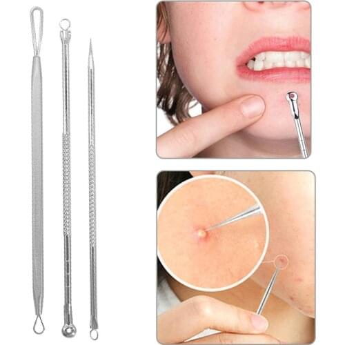 3Pcs Blackhead Pimple Acne Remover Tool Spoon for Face Cleaning Skin Care Acne Tweezers Comedone Blemish Extractor Needle