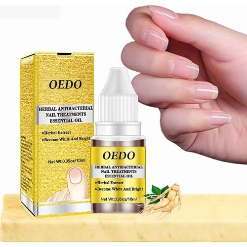 Nail Fungal Treatment Feet Care Essence Nail Foot Whitening Toe Nail Fungus Removal Gel Anti Infection Paronychia Onychomycosis