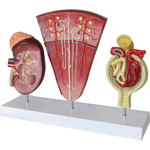 Renal model Urology Renal model Renal nephron Renal glomerulonephritis