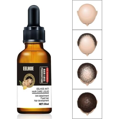 30ml Hair Growth Oil Ginger Germinal Oil Anti Hair Loss Liquid Hair Growth Oil Ginger Regrowth Hair Serum Hair Loss Treatment