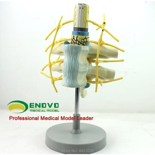 ENOVO Nerve fiber bundle in the spinal cord model of the thoracic spinal cord
