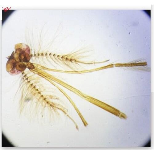 10PCS Animal Tissue Slices Piercing and Suction Mouthparts Mount Mosquito Mouthparts Microscope Slides Mosquito Male Mouth Parts
