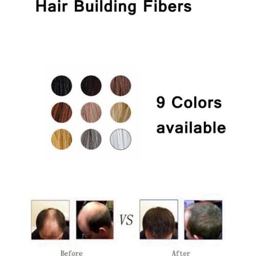 Sayoo Hair Loss Remedies