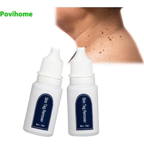 10ml Skin Tag Removerr Genital Wart Treatment Mole & Genital Wart fast Remove Papillomas Foot Corn Medical Repair Liquid C2217