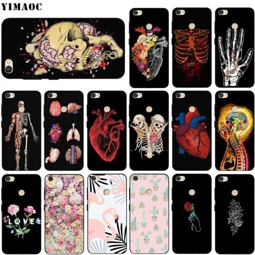 Human Anatomy Case for Xiaomi Redmi Note 4 4x 4A 5 5A 6 7A 8 8T Pro Prime Plus K20 K30 Poco X2
