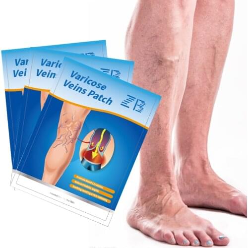 18/24/30Pcs Chinese Medical Patch Teratment Varicose Veins Herbal Plaster Vasculitis Phlebitis Spider Leg Removal Patch