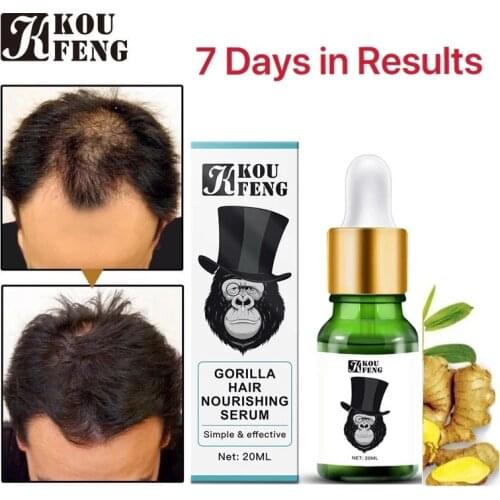 Hair growth thickener anti-hair loss care regeneration treatment essential oils for men and women, suitable for all hair types