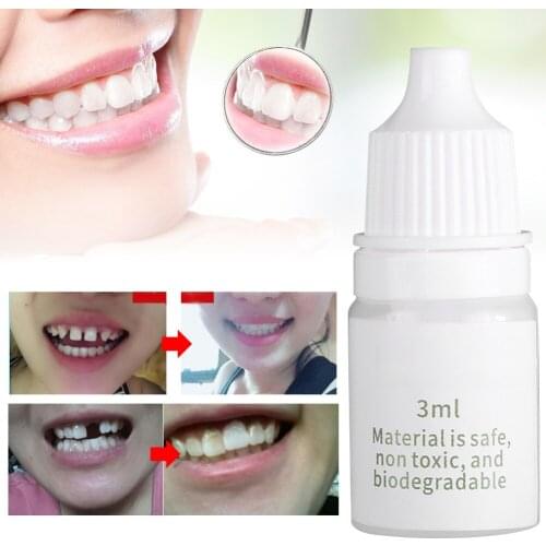 Temporary Tooth Repair Fix Broken Teeth Dental Restoration Fill Missing Teeth Gaps Between Teeth Filling Material Dental Repair