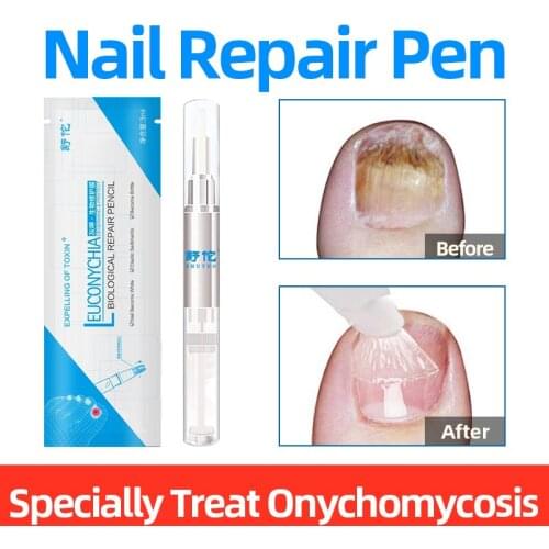1PC Onychomycosis Treatment Pen Fungal Nail Remove Antibacteria Liquid Nail Repair Care Solution