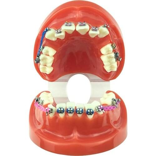 Dental Orthodontic teeth model with brackets and ligature wire affixed Dental Supplies